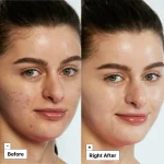 Dr.Jart+ - Cicapair™ Tiger Grass Color Correcting Treatment