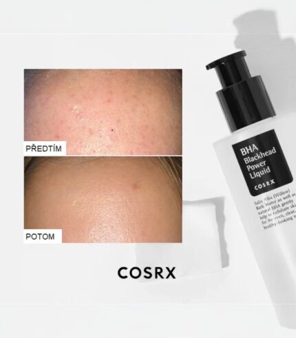 COSRX - BHA Blackhead Power Liquid